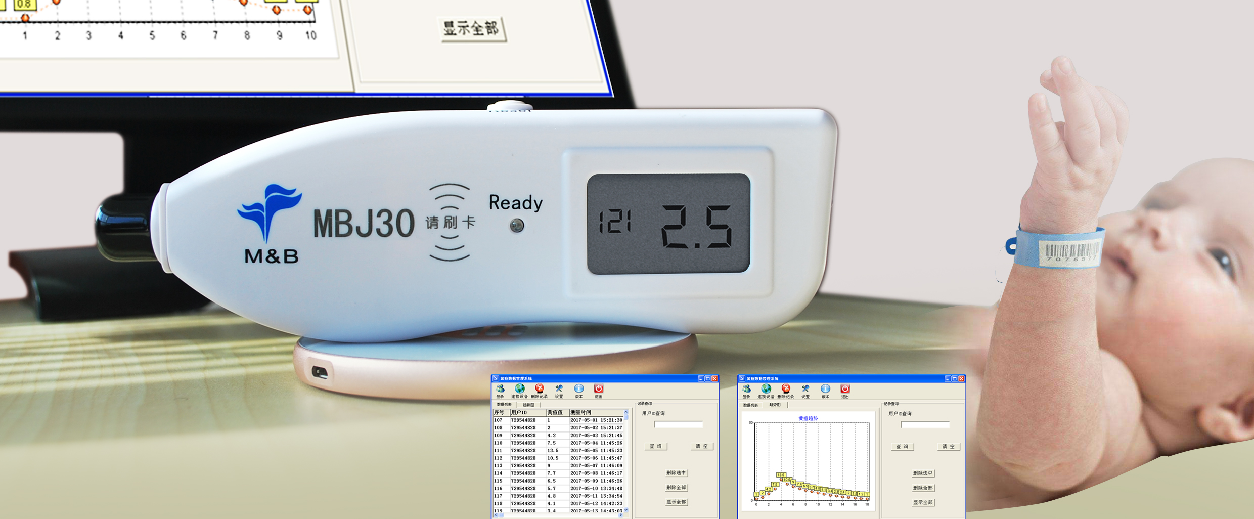 Transcutaneous jaundice detector